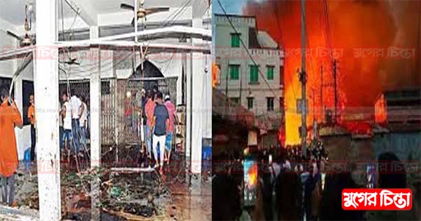 ধনী জেলায় বার্ন ইউনিট স্থাপনে ধীরগতি