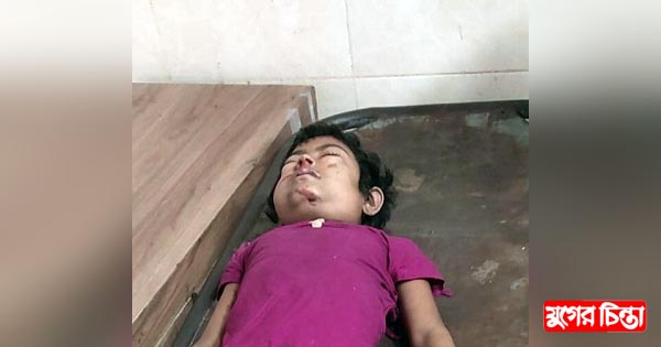 ভোলাইলে ইজিবাইকের&nbsp;চাপায় শিশু নিহত