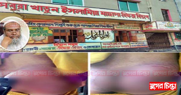 সিদ্ধিরগঞ্জে মাদ্রাসায় দুই ছাত্রকে পিটিয়ে জখম