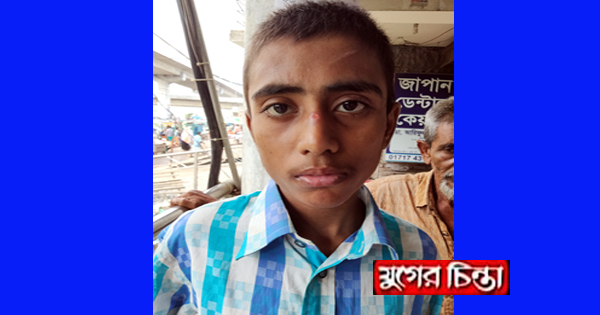 হাত-পা বেঁধে মারধরের পর প্রতিবন্ধী শিশুকে&nbsp;ঝলসে দিল শিক্ষক