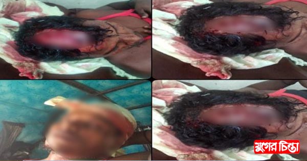 তুচ্ছ ঘটনায় দু&rsquo;গ্রুপের সংঘর্ষে আহত ১০