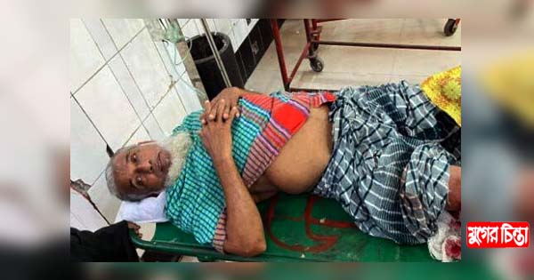 জেল থেকে ছাড়া পেয়ে মামলার সাক্ষীকে ১৭বার জুতা পেটা করল আসামিরা