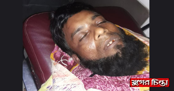 ইজিবাইকের ধাক্কায় শ্রমিকের মর্মান্তিক মৃত্যু