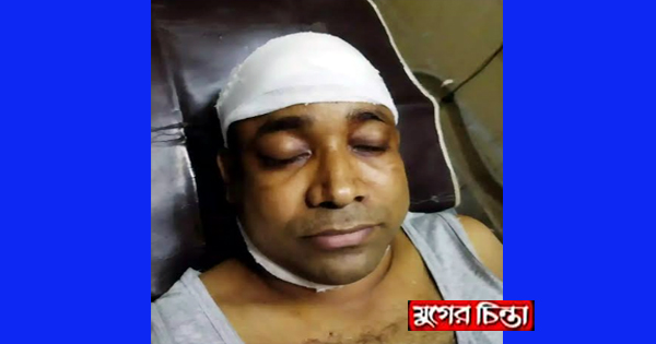 রূপগঞ্জে সাংবাদিকের উপর সন্ত্রাসী হামলা, অবস্থা আশঙ্কাজনক!