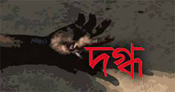 সোনারগাঁয়ে পেপার মিলে অগ্নিকাণ্ডে দগ্ধ ৪ শ্রমিক