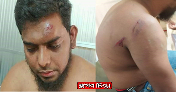 ফটো সাংবাদিক প্রীতমকে মারধর, থানায় অভিযোগ