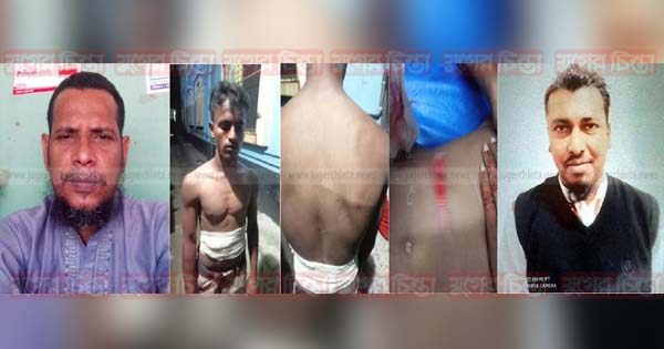 এবার গার্মেন্টসকর্মীদের কুপিয়ে জখম