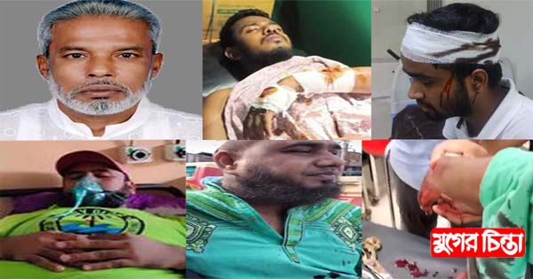 পদযাত্রায় সংঘর্ষে সোনারগাঁ বিএনপির সভাপতি মান্নানসহ আহত বেশকয়েকজন